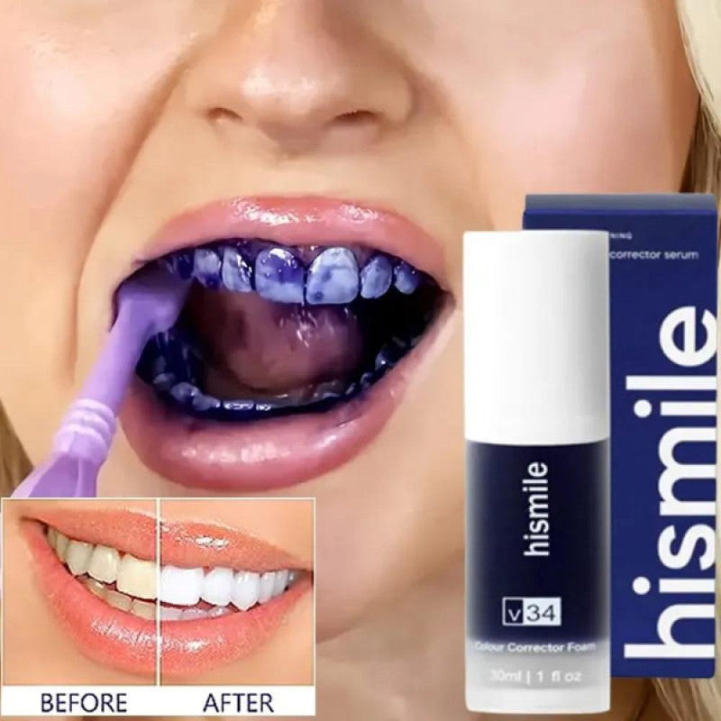 Hismile Teeth Whitening Kit – Fast, Safe, Pain-Free Whitening | Enamel-Friendly & Dentist-Approved