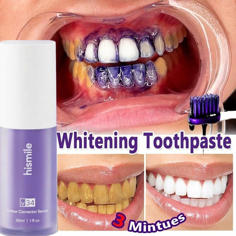 Hismile Teeth Whitening Kit – Fast, Safe, Pain-Free Whitening | Enamel-Friendly & Dentist-Approved